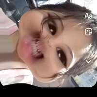 TG nek
