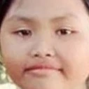 Thốn lằm