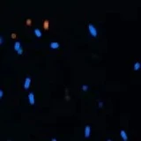 ALL