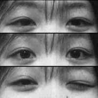 Con mặt L tgia