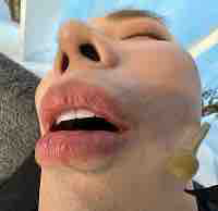 Erik bị mốc nền 🦥💅🏻