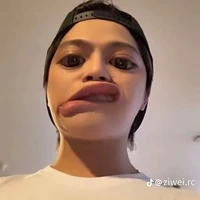 tg nè