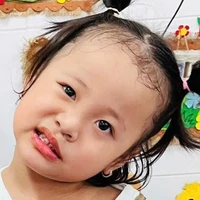 TG hay nhếch mép