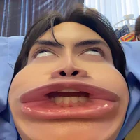 A chẻn