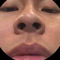Lỗ mũi của Hurrykng 