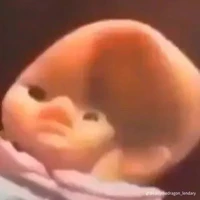 t/g xàm l