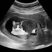 All (trừ ai thì trừ)