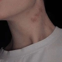 TG