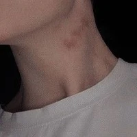 TG