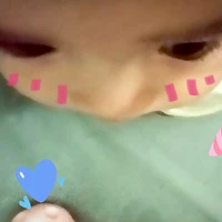 TG bị ngứa chém chép