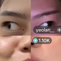 Nhỏ tg bị khờ