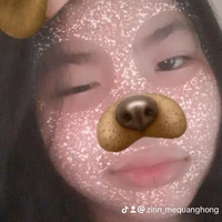 T/g bị khùm (zinn)