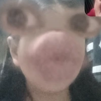 TG tẻn tẻn