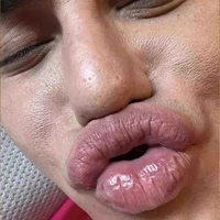 All(trừ ai thì trừ)