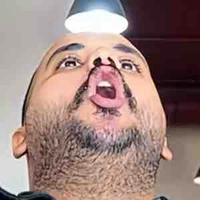 all