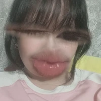 Con tg bị điên