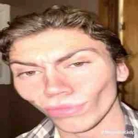 Hệ thống ngầu lòi(trĩ)