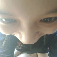 con t/ g bị khùn