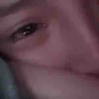 T/G bị liệt tay💔