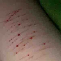 T/G bị liệt tay💔