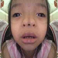All