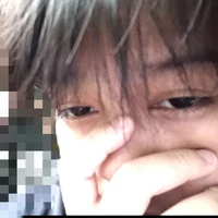 tg dzai hay cắn móng tay