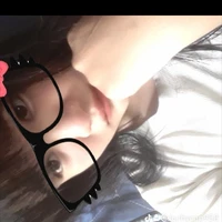 T/g xấu xí 