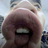 all