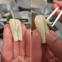 Nên cho SE ko?