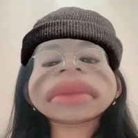 t/g hay ngứa đít