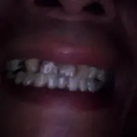 T/G (hết ảnh r😟)