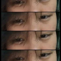 T/g xoài