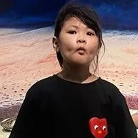 TG bị gay