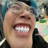 T/G