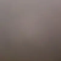 quang não