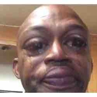 Tg bị khùm điên🐸👍