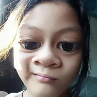 Con TG bị ngáo đá