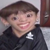 TG não xoắn