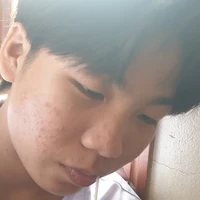 tg