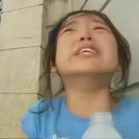 Shin ẹ bị ẻ chảy giai đoạn cuối