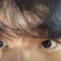 chobi