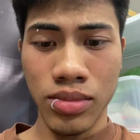 Pé 7 cục cứk màu zàng khè [Trúng Nguyền]