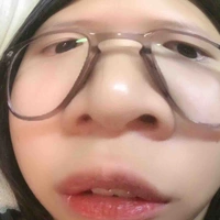 T/g bị đin:))