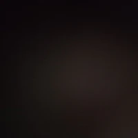 NVP
