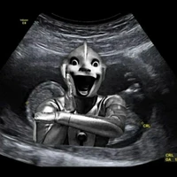 𝐊𝐞̉ 𝐧𝐚̀𝐨?