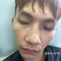 đỏ