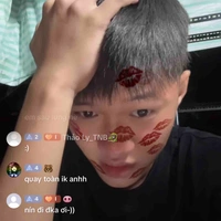 Dẹo bị lỏ🖕