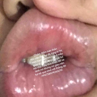 Người bí ẩn