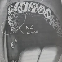 bất thường 4.5 ( thầy Long )