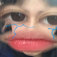 y/n